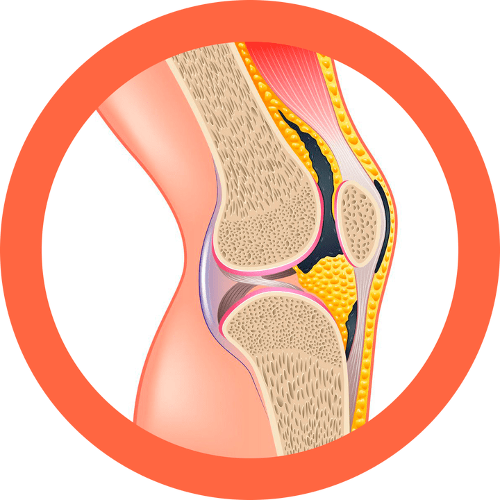 Hondroten - restaura as articulacións e os músculos